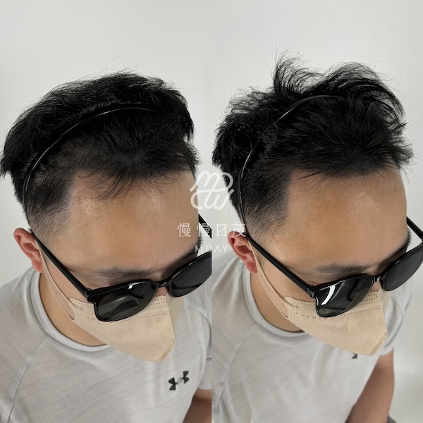 濃密款