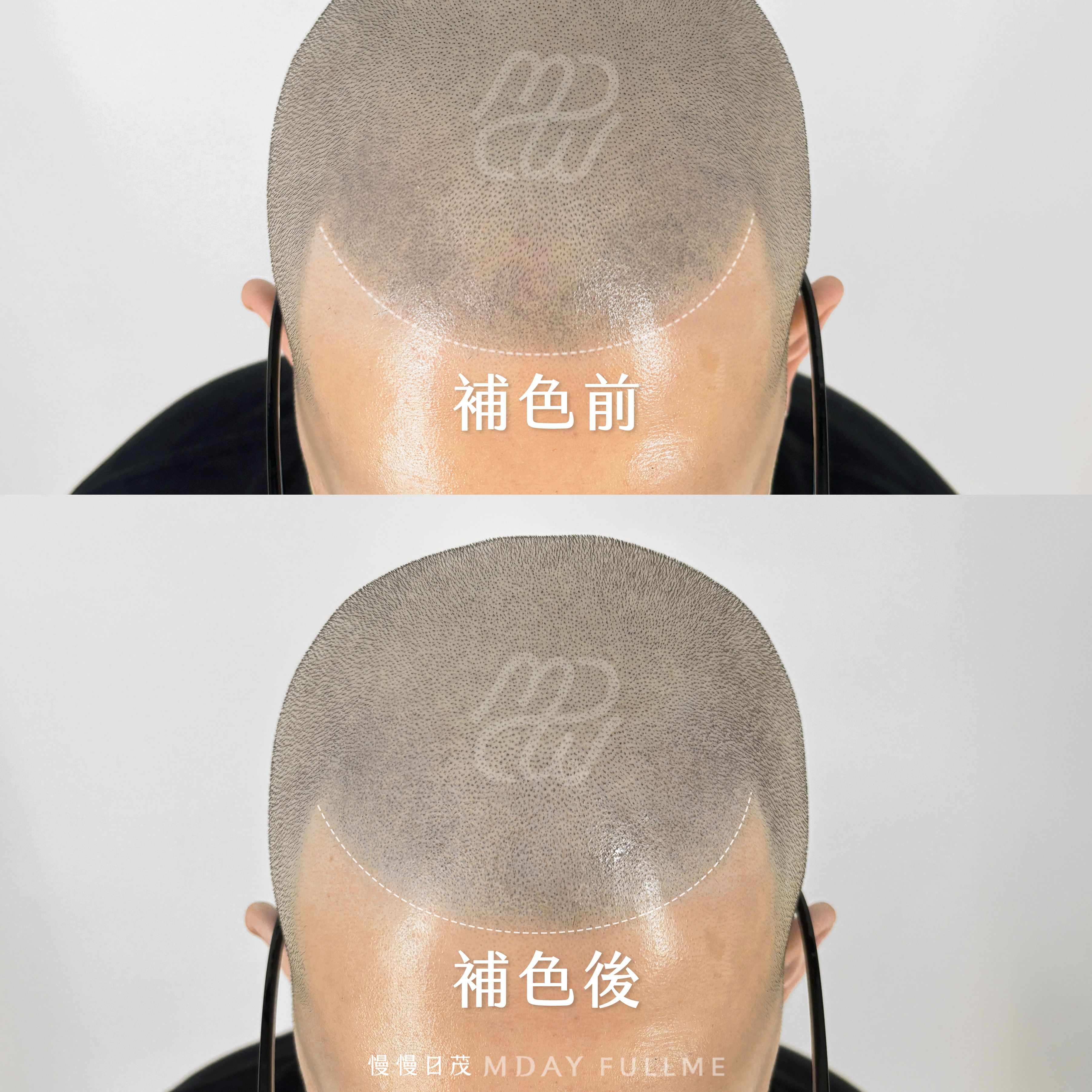 後期留色