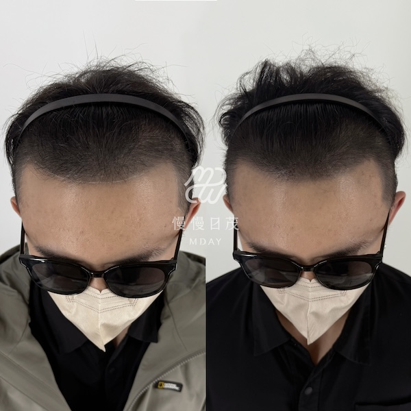 後期留色