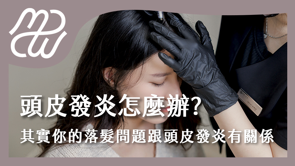 頭皮發炎怎麼辦？其實你的落髮問題跟頭皮發炎有關係！
